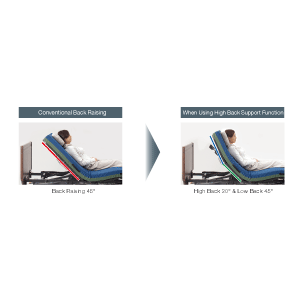 Reduced Risk of Aspiration